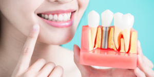 woman smiling holding a dental implant