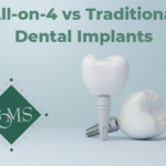 All-on-4-vs-traditional-dental-implants